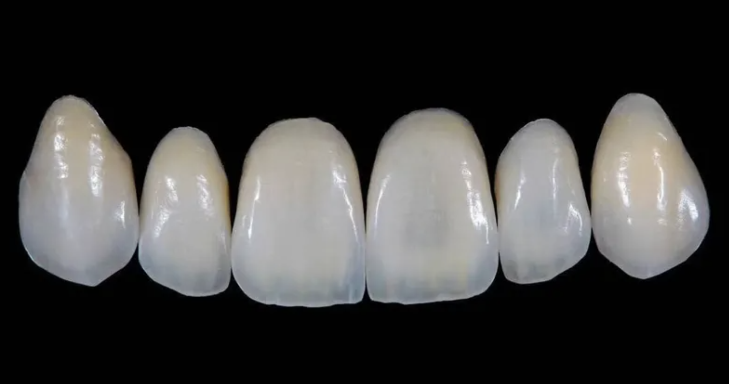 All-Ceramic Restorations