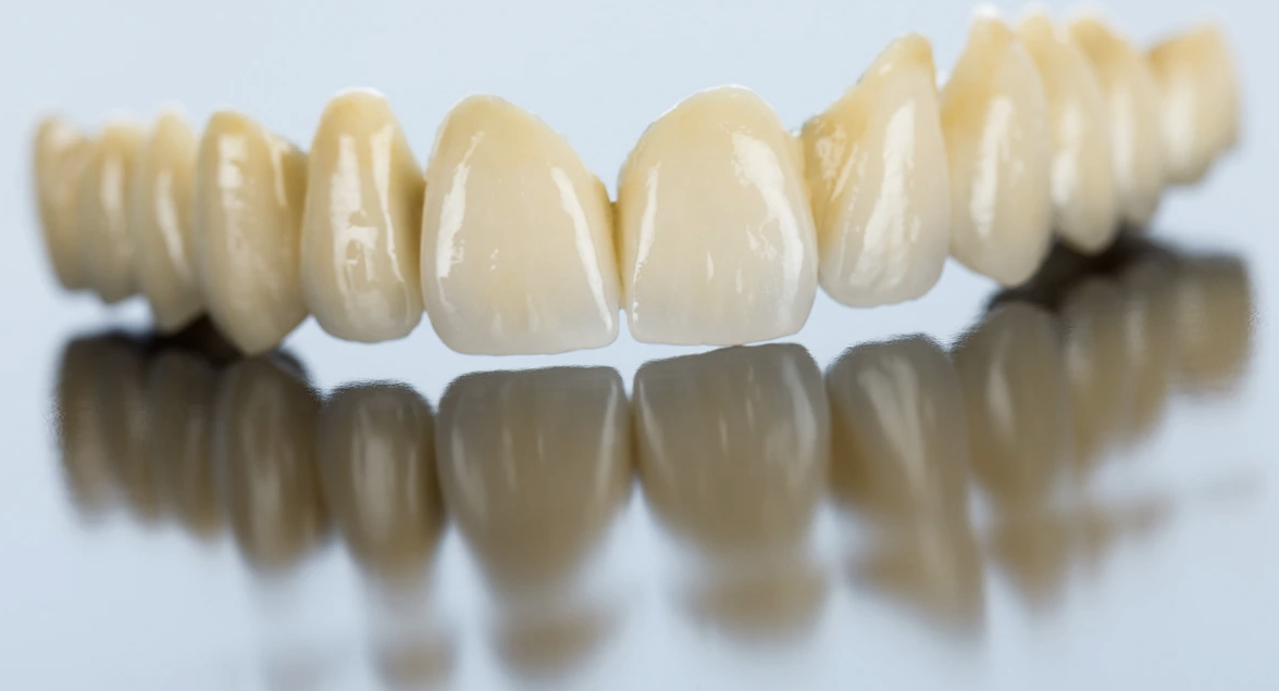Dental Crowns